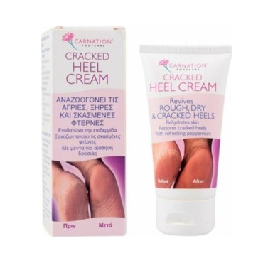 Carnation Cracked Heel Cream 50ml